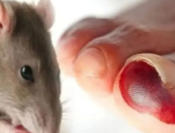 Dokter Ungkap Gejala Mematikan Infeksi Virus Hanta dari Kotoran Tikus